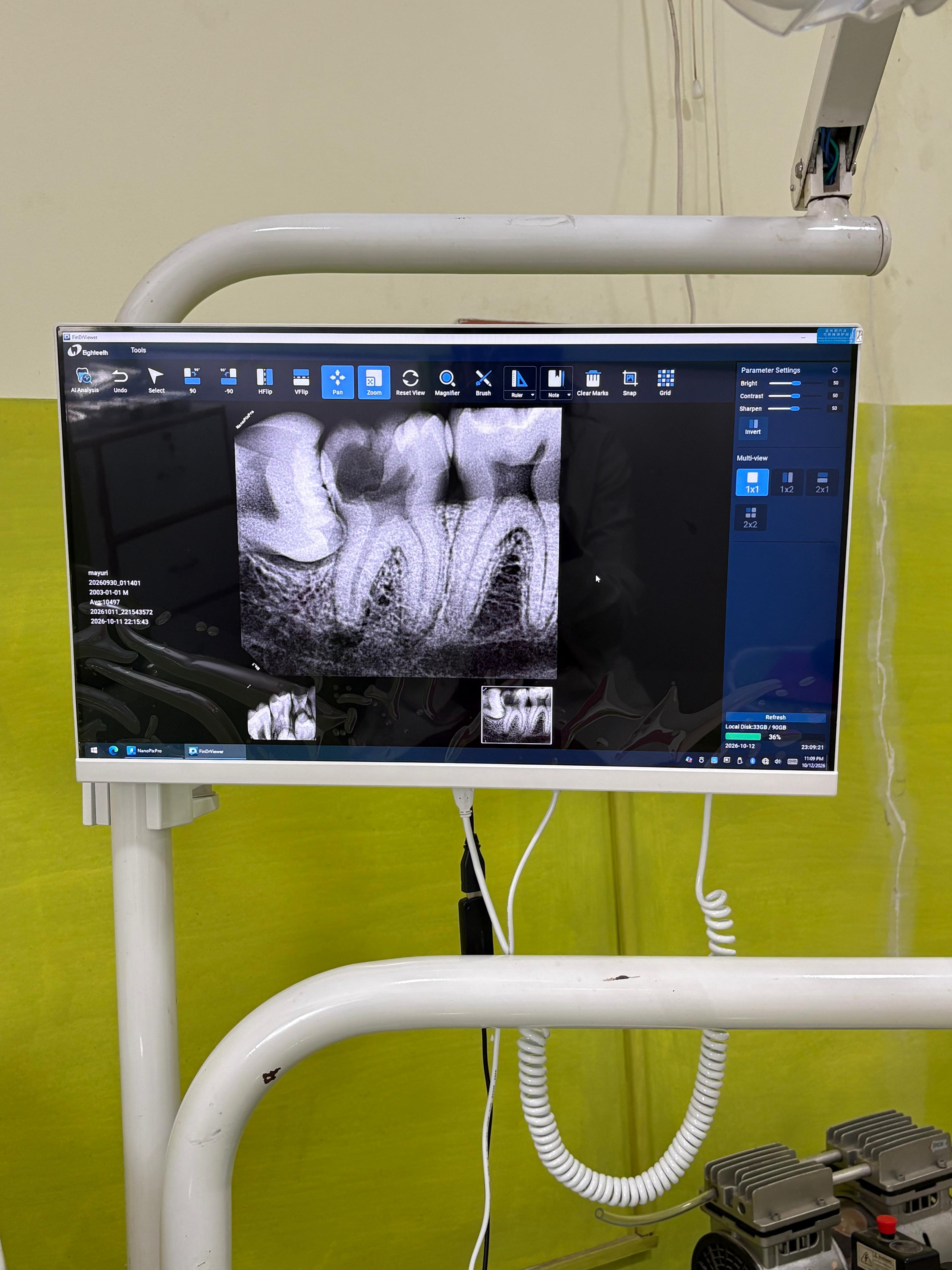 Digital dental RVG X-ray displayed on a monitor at Narumugai Dental and Maxillofacial Centre