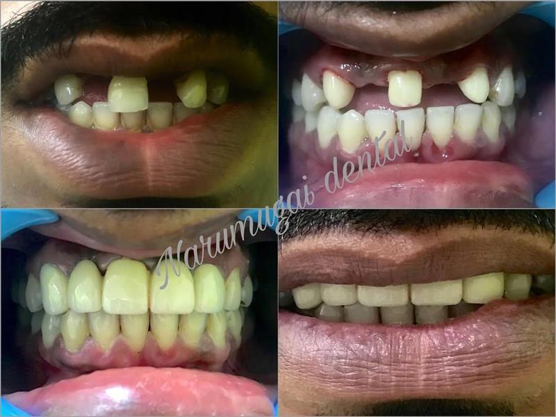 Second dental treatment case provided by the clinic