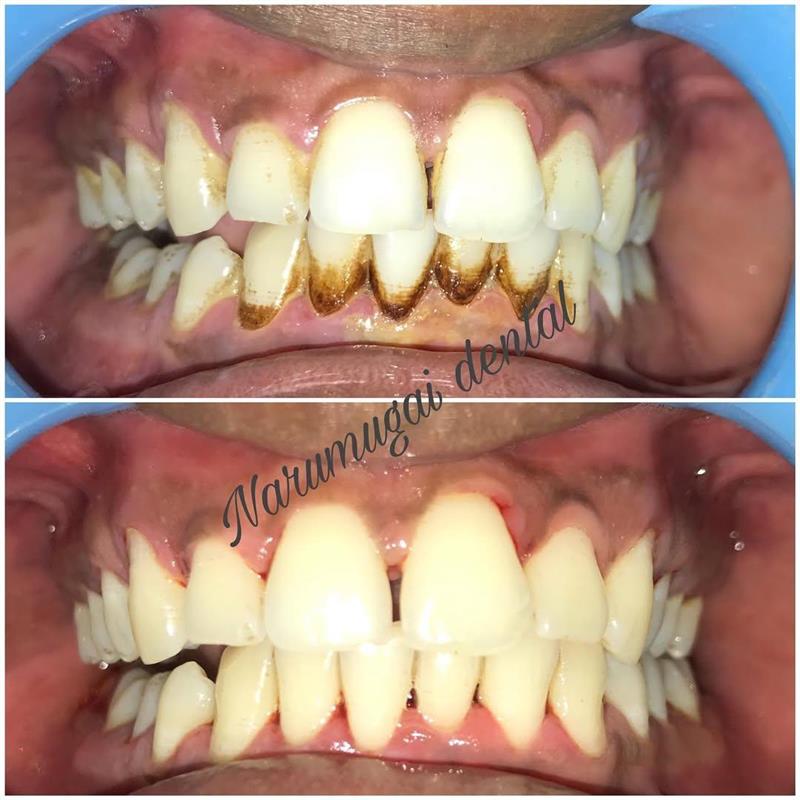 Third dental treatment case provided by the clinic